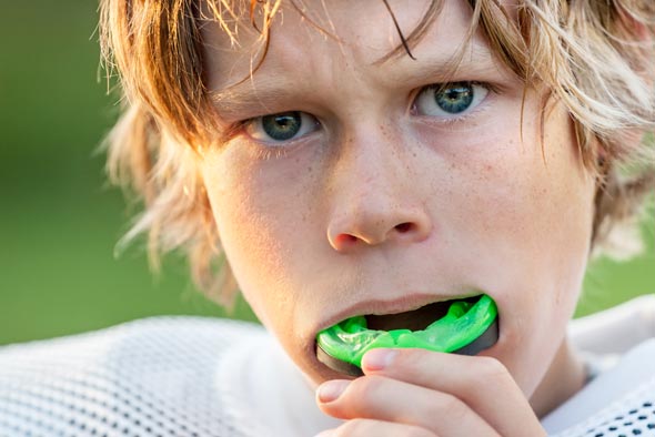 7 Facts about Your Sports Mouth Guard Grand Rapids, MI