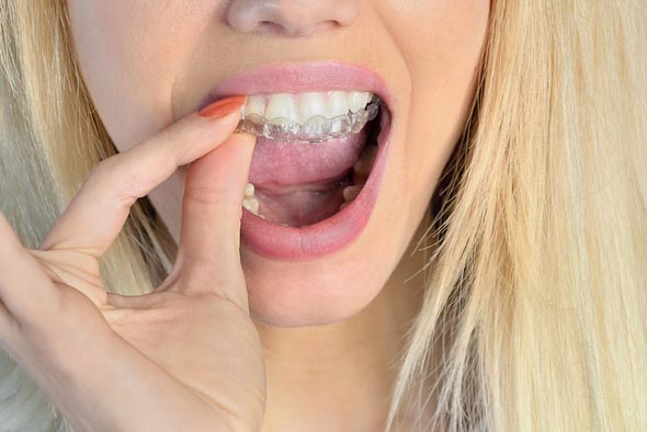 5 Reasons to Choose Invisalign over Braces Grand Rapids, MI 5 Reasons to Choose Invisalign over Braces Grand Rapids, MI