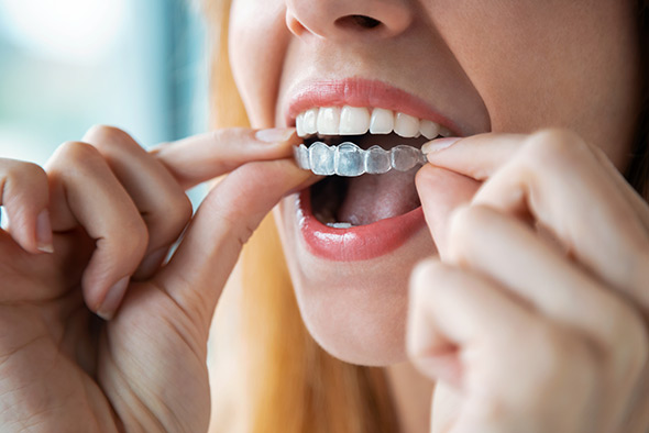 invisalign dentistry grand rapids mi dentist